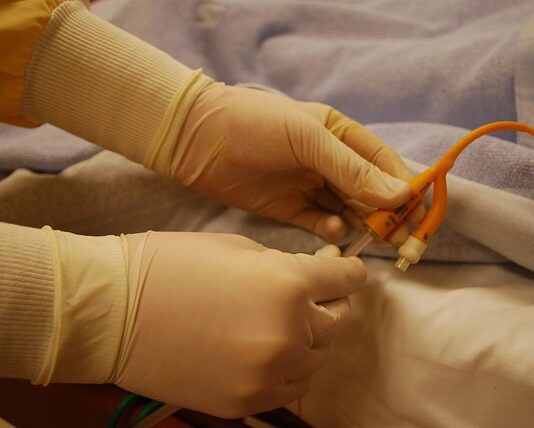 Jak długo może być podłączony cewnik?